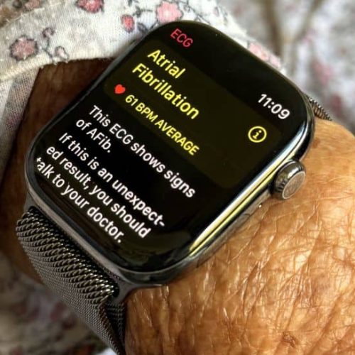 Apple Watch Series 10 Saves Elderly Woman By Detecting Irregular Heartbeat: Netizens React To Life-Saving Feature | Technology News